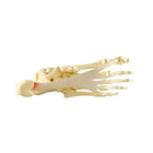 Plantarfasziitis-Modell – Fuß/Knöchel