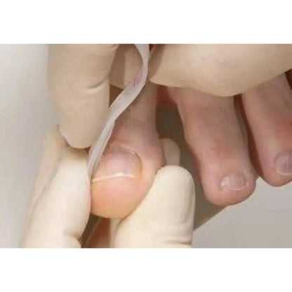 Languettes B/S Quick x5 - My Podologie