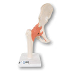 Modèle fonctionnel de luxe de l'articulation de la hanche - Anatomie et pathologie