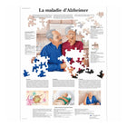Anatomische Tafel - Alzheimer-Krankheit - Anatomie und Pathologie
