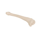 Tibia – Anatomie und Pathologie